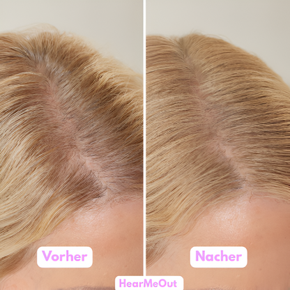 HairFiller für Frauen